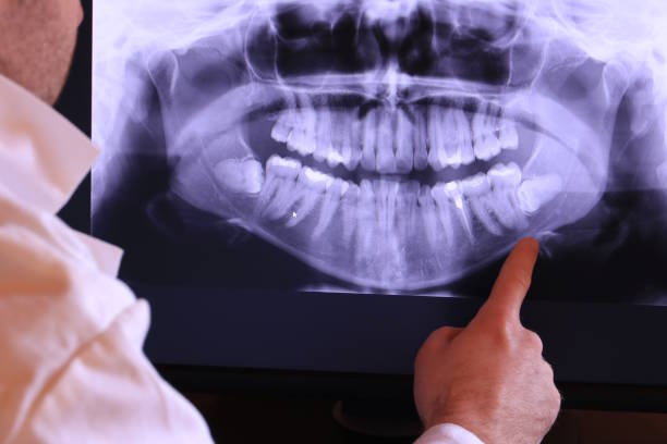 Best Urgent Tooth Repair  in West Park, FL